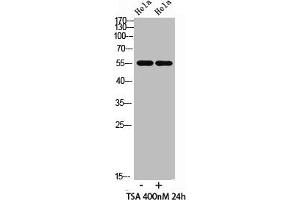 Western blot analysis of hela cells,hela cells, antibody was diluted at 500. (HNF4A Antikörper  (acLys106))