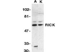 Image no. 1 for anti-Receptor-Interacting Serine-threonine Kinase 2 (RIPK2) (N-Term) antibody (ABIN201933) (RIPK2 Antikörper  (N-Term))