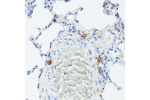 Immunohistochemistry (IHC) image for anti-TIA1 Cytotoxic Granule-Associated RNA Binding Protein-Like 1 (TIAL1) (AA 266-375) antibody (ABIN6149144)
