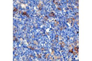 IHC analysis of PDCD1 using anti PDCD1 antibody (ABIN5518784). (PD-1 Antikörper  (N-Term))