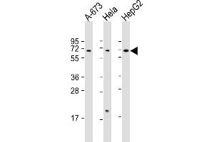 All lanes : Anti-CHRNA4 Antibody (C-Term) at 1:2000 dilution Lane 1: A-673 whole cell lysate Lane 2: Hela whole cell lysate Lane 3: HepG2 whole cell lysate Lysates/proteins at 20 μg per lane. (CHRNA4 Antikörper  (AA 472-503))