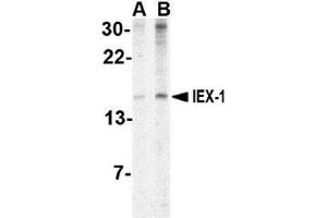 Western blot analysis of IEX1 in human brain tissue lysate with AP30400PU-N IEX1 antibody at (A) 2 and (B) 4 μg/ml. (IER3 Antikörper  (Center))