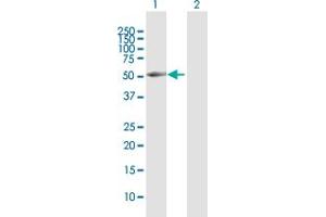 Western Blot analysis of BRUNOL4 expression in transfected 293T cell line by BRUNOL4 MaxPab polyclonal antibody. (CELF4 Antikörper  (AA 1-484))