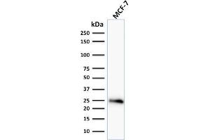 Western Blot Analysis of human MCF-7 cell lysate using Bcl-2 Mouse Monoclonal Antibody (BCL2/796). (Bcl-2 Antikörper)