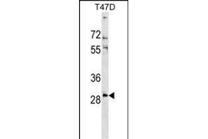 RN Antibody (Center) (ABIN1538610 and ABIN2849190) western blot analysis in T47D cell line lysates (35 μg/lane). (RNF138 Antikörper  (AA 76-103))