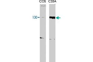 RBL2 monoclonal antibody, clone KAB40  recognizes both the phosphorylated and unphosphorylated forms of p130 at aMW of 130kDa.