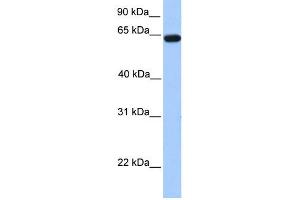 WB Suggested Anti-ZNF342 Antibody Titration:  0. (Zinc Finger Protein 296 (ZNF296) (N-Term) Antikörper)