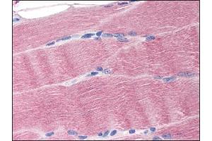 Image no. 1 for anti-Solute Carrier Family 40 (Iron-Regulated Transporter), Member 1 (SLC40A1) (N-Term) antibody (ABIN372307)