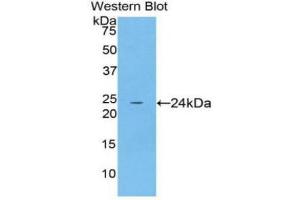 Western Blotting (WB) image for anti-Spectrin alpha Chain, Brain (SPTAN1) (AA 22-210) antibody (ABIN1860637)
