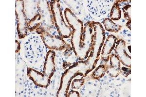 IHC-P: SLC22A6 antibody testing of rat kidney tissue