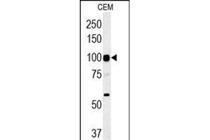 ATP6V0A4 Antibody (Center) (ABIN651562 and ABIN2840303) western blot analysis in CEM cell line lysates (35 μg/lane). (ATP6V0A4 Antikörper  (AA 235-261))