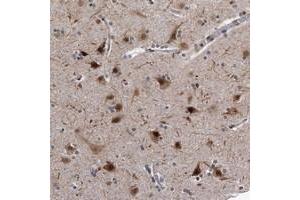 Immunohistochemical staining of human cerebral cortex with KIAA1429 polyclonal antibody  shows strong nuclear and cytoplasmic positivity in neuronal cells at 1:10-1:20 dilution. (VIRMA/KIAA1429 Antikörper)