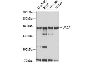 Western blot analysis of extracts of various cell lines, using UACA antibody  at 1:1000 dilution. (UACA Antikörper  (AA 1-90))
