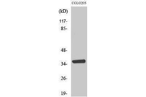 Western Blotting (WB) image for anti-Aminoadipate-Semialdehyde Dehydrogenase-phosphopantetheinyl Transferase (AASDHPPT) (N-Term) antibody (ABIN3183108) (AASDHPPT Antikörper  (N-Term))