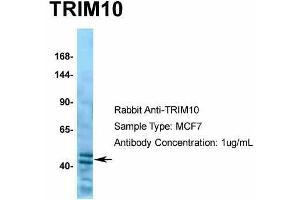 Human MCF7; Host: Rabbit. (TRIM10 Antikörper  (C-Term))