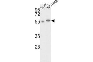 Western Blotting (WB) image for anti-Galactokinase 2 (GALK2) antibody (ABIN3002978) (GALK2 Antikörper)