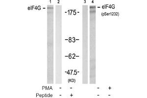 Image no. 2 for anti-Eukaryotic Translation Initiation Factor 4 Gamma, 1 (EIF4G1) (pSer1232) antibody (ABIN319277) (EIF4G1 Antikörper  (pSer1232))