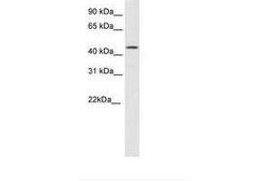 Image no. 1 for anti-High Mobility Group 20B (HMG20B) (N-Term) antibody (ABIN6736097) (HMG20B Antikörper  (N-Term))