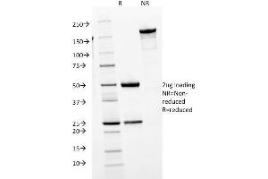 SDS-PAGE Analysis Purified IgM Mouse Monoclonal Antibody (IGHM/1623). (IGHM Antikörper)