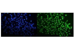 IF analysis of SPAK/STK39 using anti-SPAK/STK39 antibody (ABIN7601373). (STK39 Antikörper  (AA 338-545))