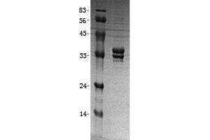 Validation with Western Blot (GGPS1 Protein (Transcript Variant 2) (His tag))