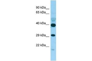 WB Suggested Anti-PISD Antibody Titration: 1. (PISD Antikörper  (C-Term))