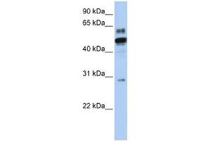 ESRRA antibody used at 1 ug/ml to detect target protein. (ESRRA Antikörper  (N-Term))