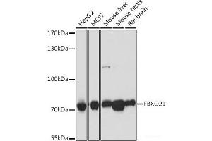 Western blot analysis of extracts of various cell lines using FBXO21 Polyclonal Antibody at dilution of 1:1000. (FBXO21 Antikörper)
