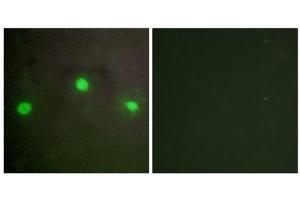 Immunofluorescence analysis of A549 cells, using ATRX antibody. (ATRX Antikörper  (N-Term))
