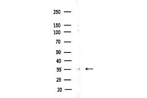anti-Protein Kinase C, delta Binding Protein (PRKCDBP) (Internal Region) antibody