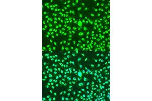Immunofluorescence analysis of U2OS cells using CCNA2 antibody. (Cyclin A Antikörper)