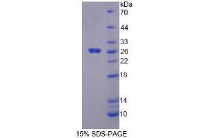 SDS-PAGE analysis of Mouse FADD Protein. (FADD Protein)