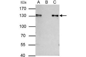IP Image MCM2 antibody [N1N2], N-term immunoprecipitates MCM2 protein in IP experiments. (MCM2 Antikörper  (N-Term))