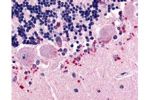 Immunohistochemistry on human brain sections (Purkinje cell layer) using CELSR3 antibody ABIN122031. (CELSR3 Antikörper  (N-Term))