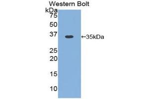 Western blot analysis of the recombinant protein. (Cyclin D1 Antikörper  (AA 1-292))