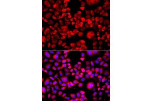 Immunofluorescence analysis of A549 cell using EIF4G1 antibody. (EIF4G1 Antikörper)