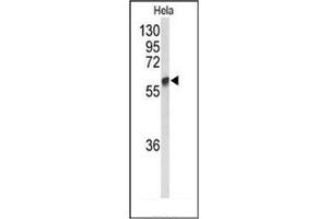 Western blot analysis of GALNT2 Antibody (N-term) in Hela cell line lysates (35ug/lane).