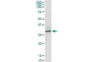 YWHAZ monoclonal antibody (M04), clone 1B3.