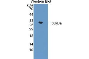 Detection of Recombinant IkBd, Mouse using Polyclonal Antibody to Inhibitory Subunit Of NF Kappa B Delta (IkBd) (IkBd Antikörper  (AA 58-304))