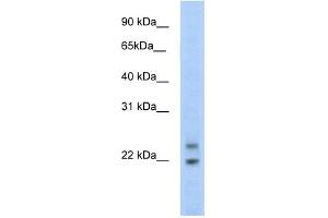 WB Suggested Anti-C330003B14RIK Antibody Titration:  5. (CPHX Antikörper  (N-Term))