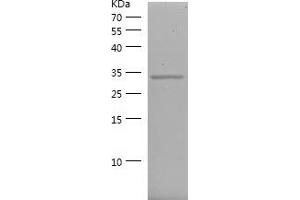CDK4 Protein (AA 207-303) (His-IF2DI Tag)
