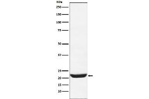Western blot analysis of NCS1 expression in 293T cell lysate.