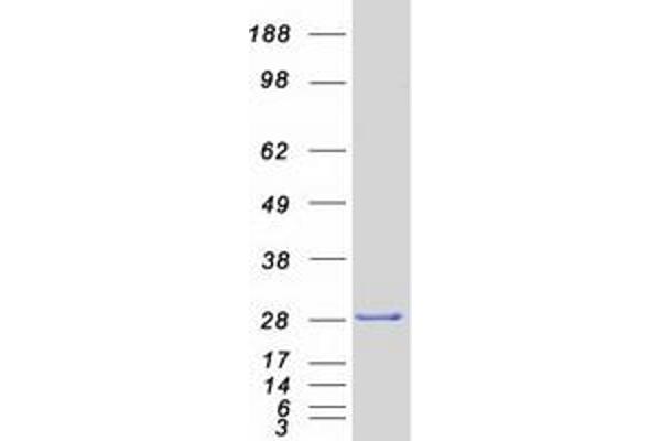 SIGMAR1 Protein (Transcript Variant 1) (Myc-DYKDDDDK Tag)