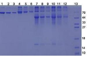 Image no. 3 for 25-Hydroxyvitamin D3 (HVD3) peptide (BSA) (ABIN5665930) (25-Hydroxyvitamin D3 (HVD3) peptide (BSA))