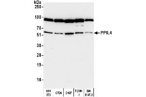 Western Blotting (WB) image for anti-Peptidylprolyl Isomerase (Cyclophilin)-Like 4 (PPIL4) (AA 375-425) antibody (ABIN7450591)