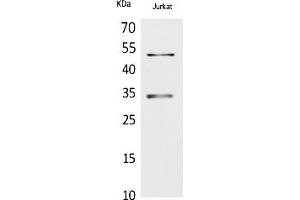 Western Blot analysis of Jurkat cells using MyoD Polyclonal Antibody.