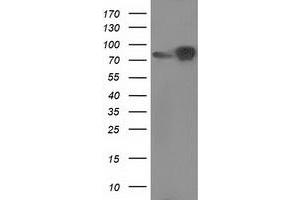 Western Blotting (WB) image for anti-Catenin (Cadherin-Associated Protein), beta 1, 88kDa (CTNNB1) antibody (ABIN1496893) (CTNNB1 Antikörper)