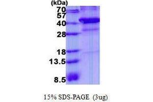 Figure annotation denotes ug of protein loaded and % gel used. (XRCC3 Protein)