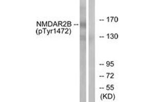 Western blot analysis of extracts from Jurkat cells treated with UV 15', using NMDAR2B (Phospho-Tyr1474) Antibody. (GRIN2B Antikörper  (pTyr1474))