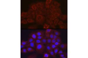 Immunofluorescence analysis of  cells using SSC/SerpinB3 Rabbit pAb (ABIN6131348, ABIN6147587, ABIN6147588 and ABIN6221070) at dilution of 1:100 (40x lens). (SERPINB3 Antikörper  (AA 1-230))
